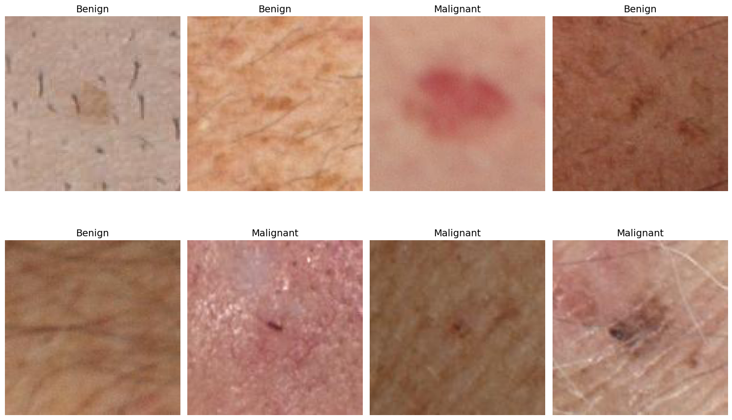 Dataset Samples — Benign and malignant skin lesion examples from ISIC