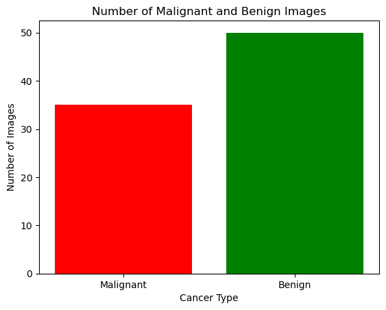 Class Distribution — 50 benign vs 35 malignant images
